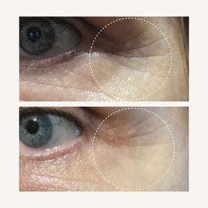 Collagen Before and After Pictures – Skin Wrinkle Results